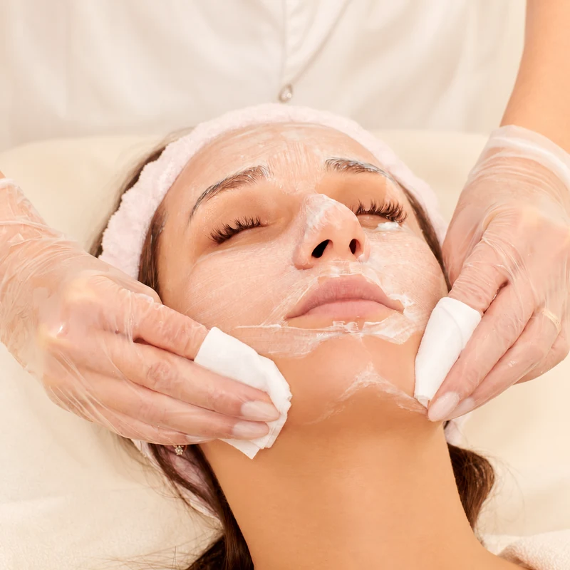 Chemical Peel